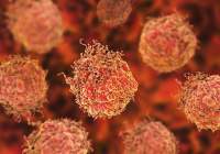 نابودی تومورهای سرطانی پروستات در کمتر از یک ساعت