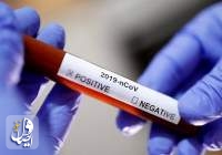 اولین آزمایش بالینی واکسن کرونا در آمریکا امروز انجام می شود