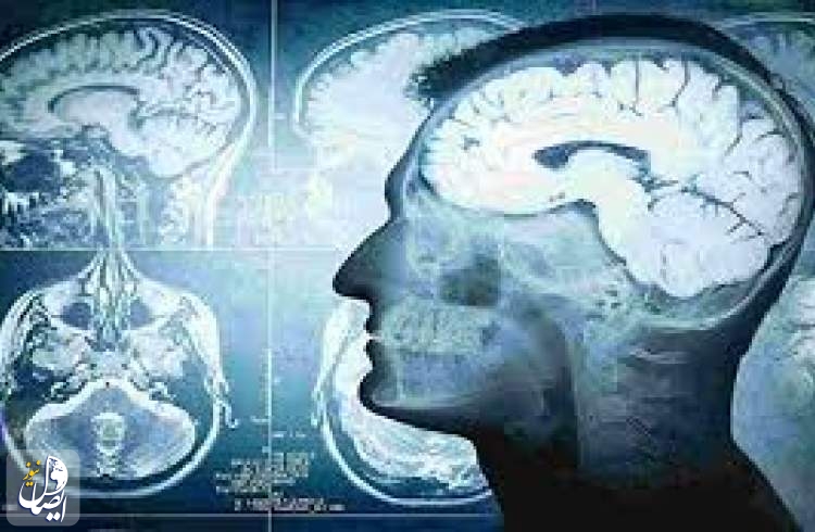 کشف عامل مهم گسترش سرطان به مغز