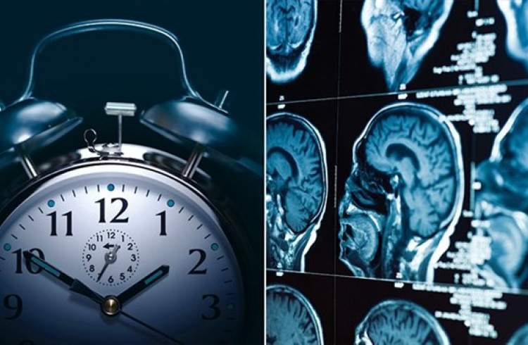 Study finds actual changes in brain after sleep loss that make pain worse