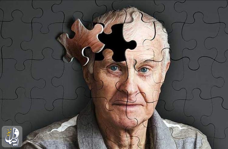 تشخیص آلزایمر ۱۷ سال زودتر از بروز بیماری ممکن شد